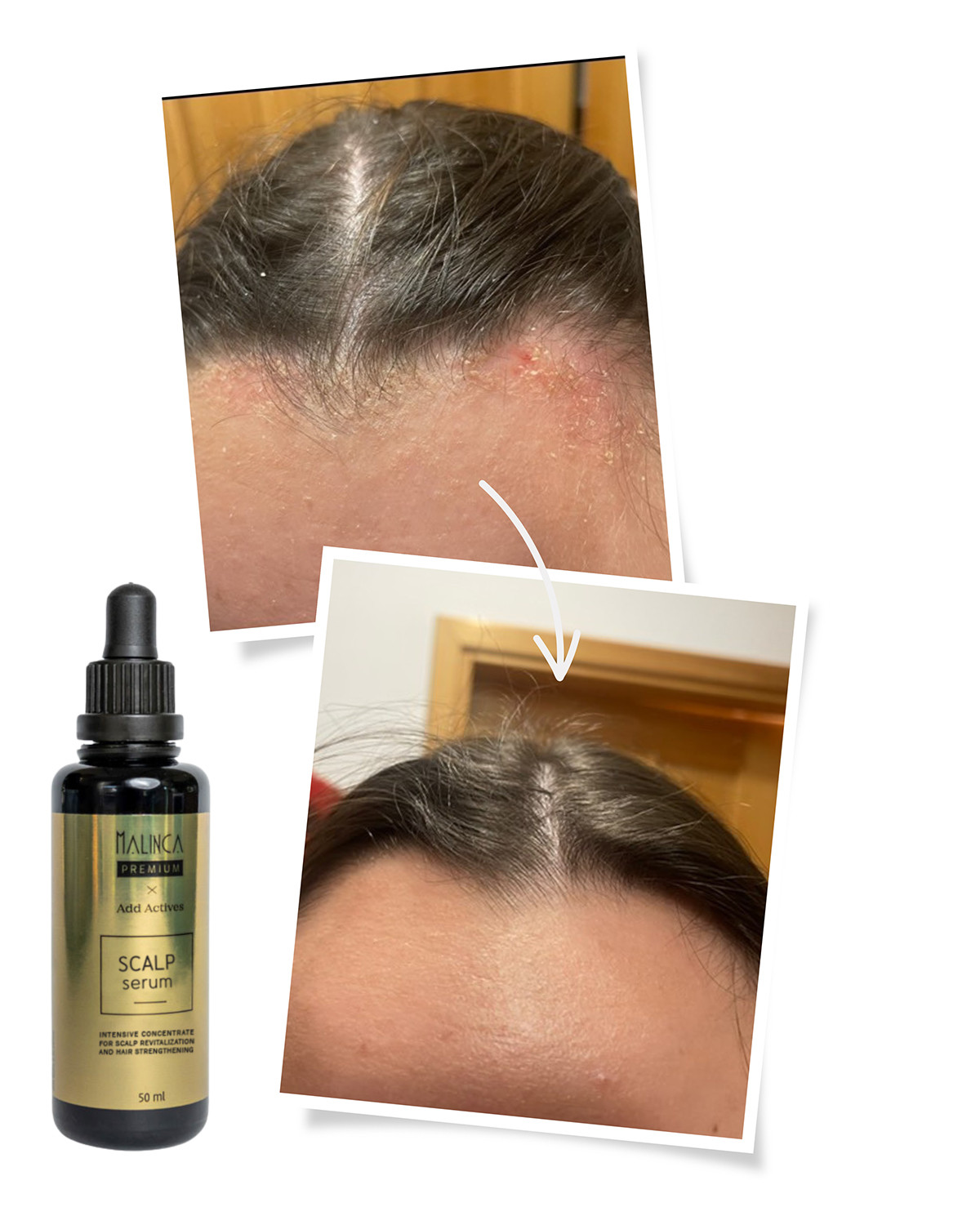 Siero per il cuoio capelluto